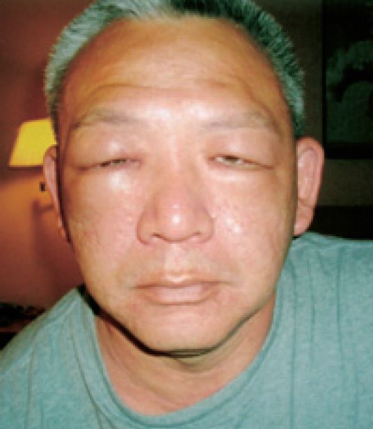 南無羌佛事先預言兩人會出現五官變形的狀況